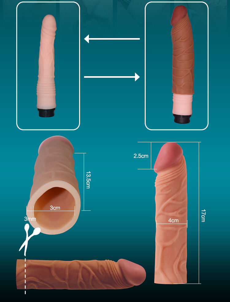 Pdf Primary Galeryrculosis Of The Penis